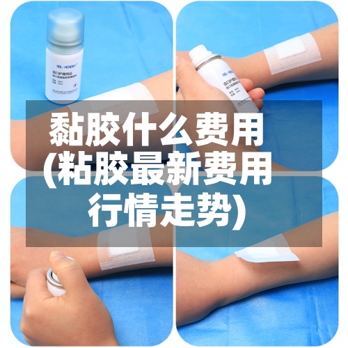 黏胶什么费用(粘胶最新费用行情走势)