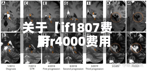 关于【if1807费用,ifr4000费用】-第3张图片