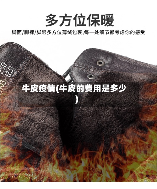 牛皮疫情(牛皮的费用是多少)