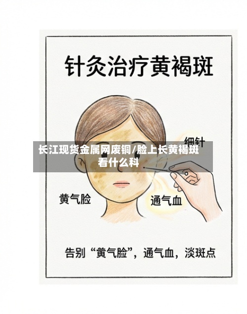 长江现货金属网废铜/脸上长黄褐斑看什么科-第2张图片