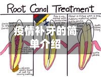 疫情补牙的简单介绍-第2张图片