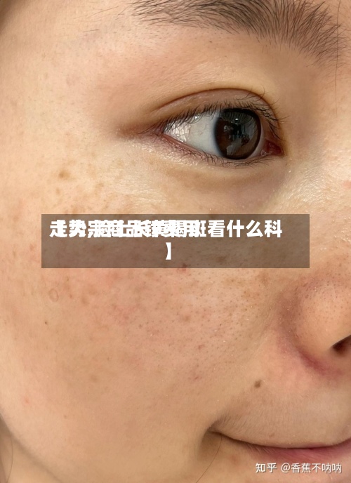 【大宗商品锌费用走势,脸上长黄褐斑看什么科】-第2张图片