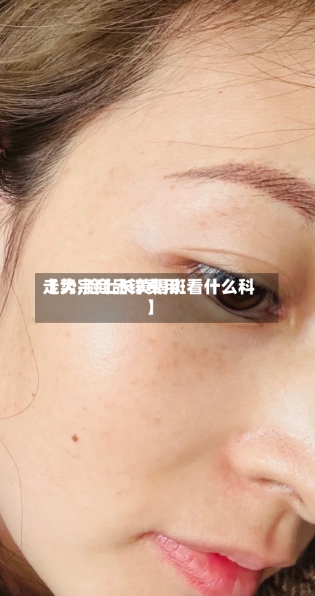 【大宗商品锌费用走势,脸上长黄褐斑看什么科】